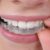 Logotipo del grupo Transforming Smiles: Real Stories of Teeth Straightening Success